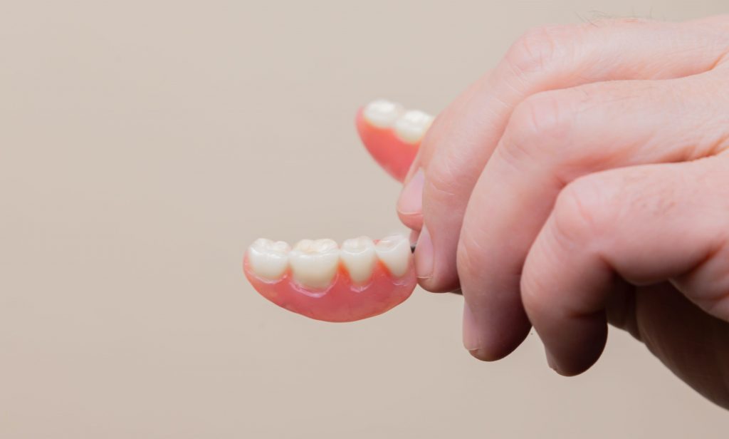 dental-implants