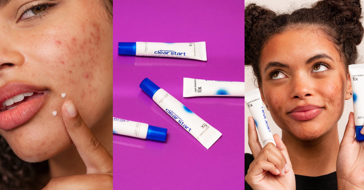 Real Skin, Real Results: Clear Start's Post-Breakout Fix is An Overachiever!