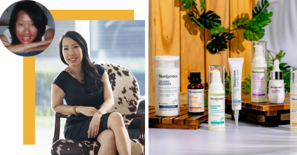 Skinlycious Founder, Jasmine Kang Tells All About Her 14 Year Battle With Acne