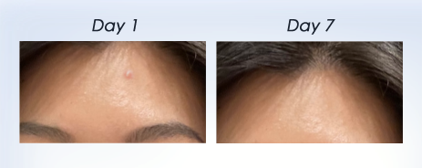 DR.WU results tightes pores before & after